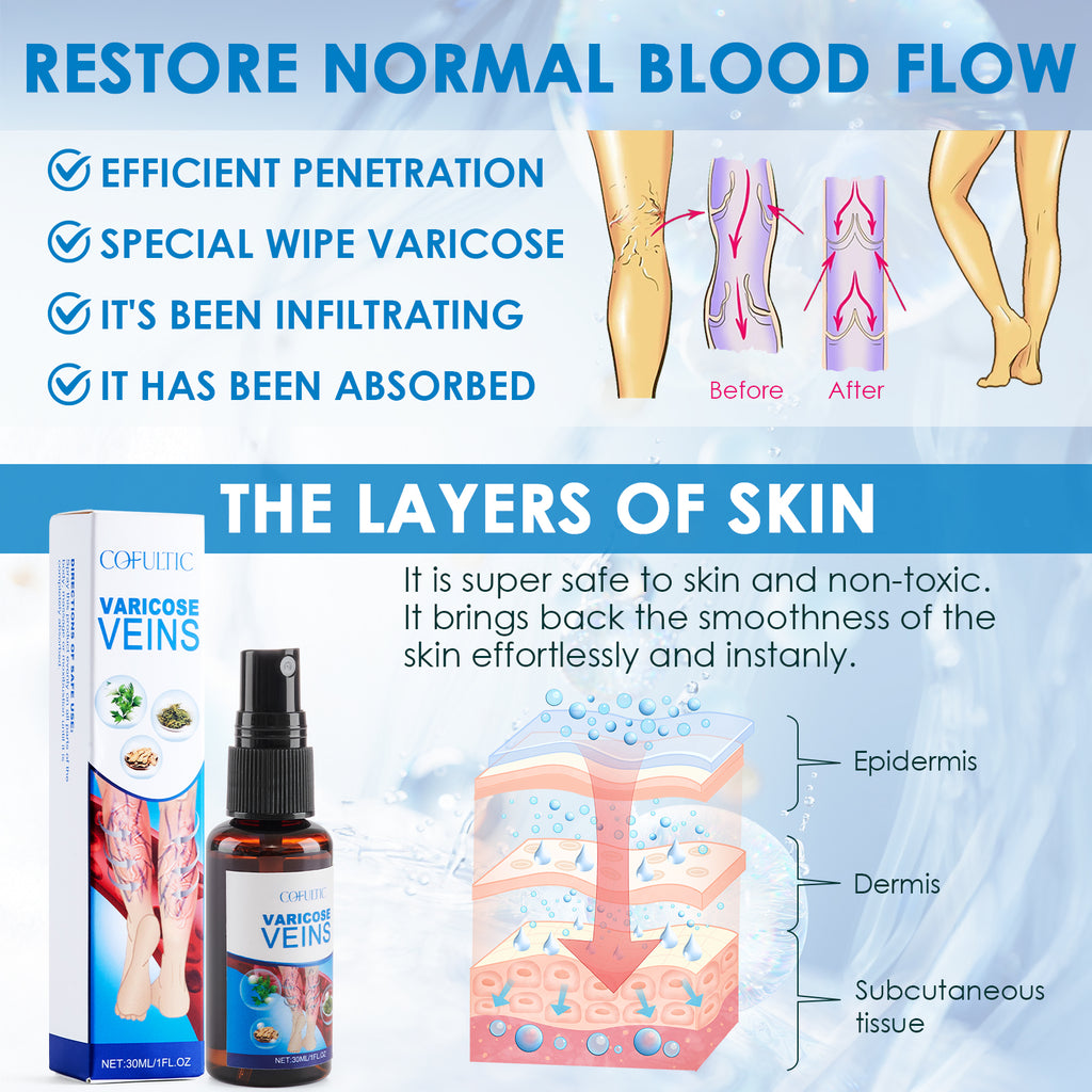 30ml Varicose Vein Spray Multi-Purpose Knee And Leg Care Spray Promote Blood Circulation